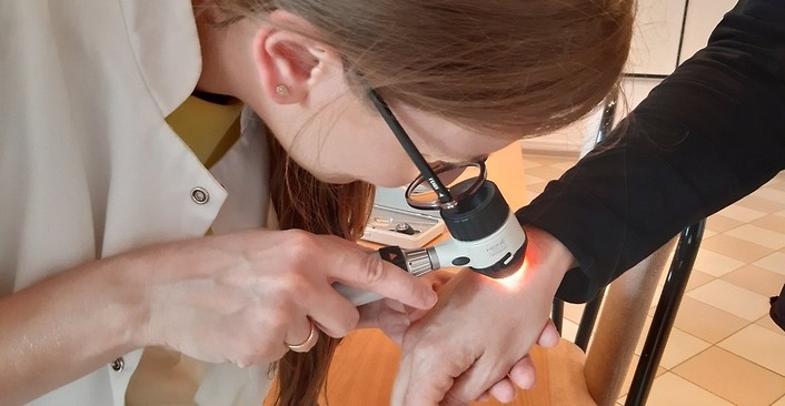 Kolorowa forografia. Lekarz bada dermatoskopem znamię na dłoni pacjenta.