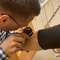 Kolorowa fotografia. Lekarz bada znamię na ręce pacjentki.