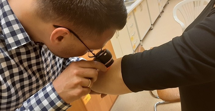 Kolorowa fotografia. Lekarz bada znamię na ręce pacjentki.