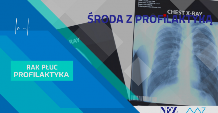 Na zdjęciu: RTG płuc. tekst w ramce: Profilaktyka - Rak płuc - Środa z Profilaktyką.