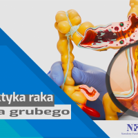 Tekst: Rak jelita grubego - Środa z Profilaktyką. Na zdjęciu schematyczny przekrój jelita