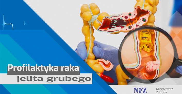 Tekst: Rak jelita grubego - Środa z Profilaktyką. Na zdjęciu schematyczny przekrój jelita
